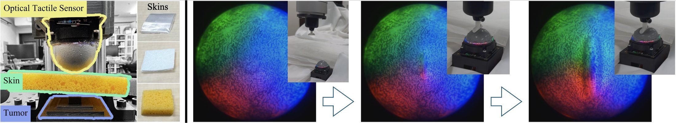 Left: the tumor-detection setup, with the optical tactile sensor above a layer of foam skin and a tumor phantom underneath, and the three foam skins. Right: three moments of trajectory following, each with the real tactile image and a photo of the robot pressing an indenter on the sensor.